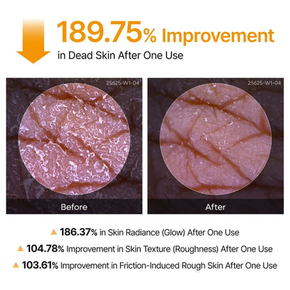 Dr Melaxin Kojic Acid Exfoliating Turmeric Spray™