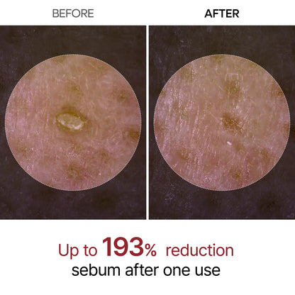 Dr Melaxin Radiance Renewal Black Rice Exfoliant Peel Shot™