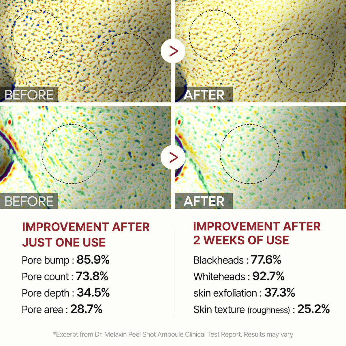 Dr Melaxin Radiance Renewal Black Rice Exfoliant Peel Shot™