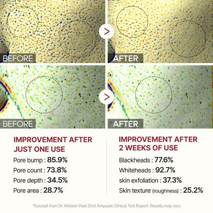 Dr Melaxin Radiance Renewal Black Rice Exfoliant Peel Shot™